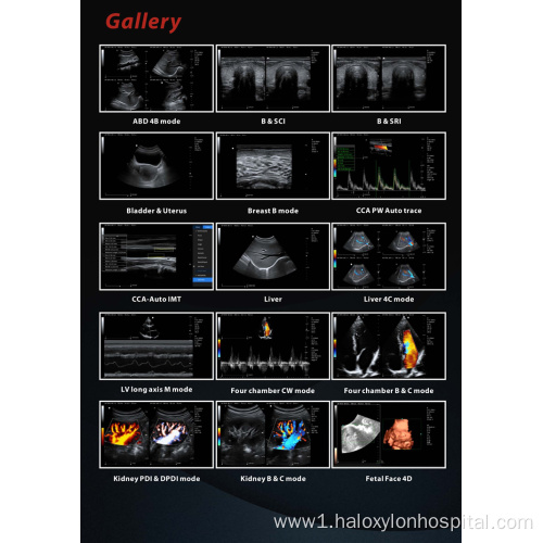 hospital mobile color ultrasound machine laptop cardiac